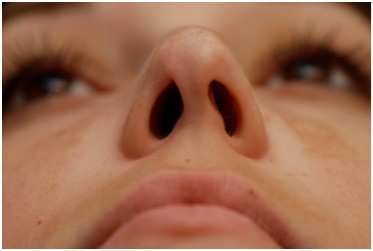 искривление перегородки носа